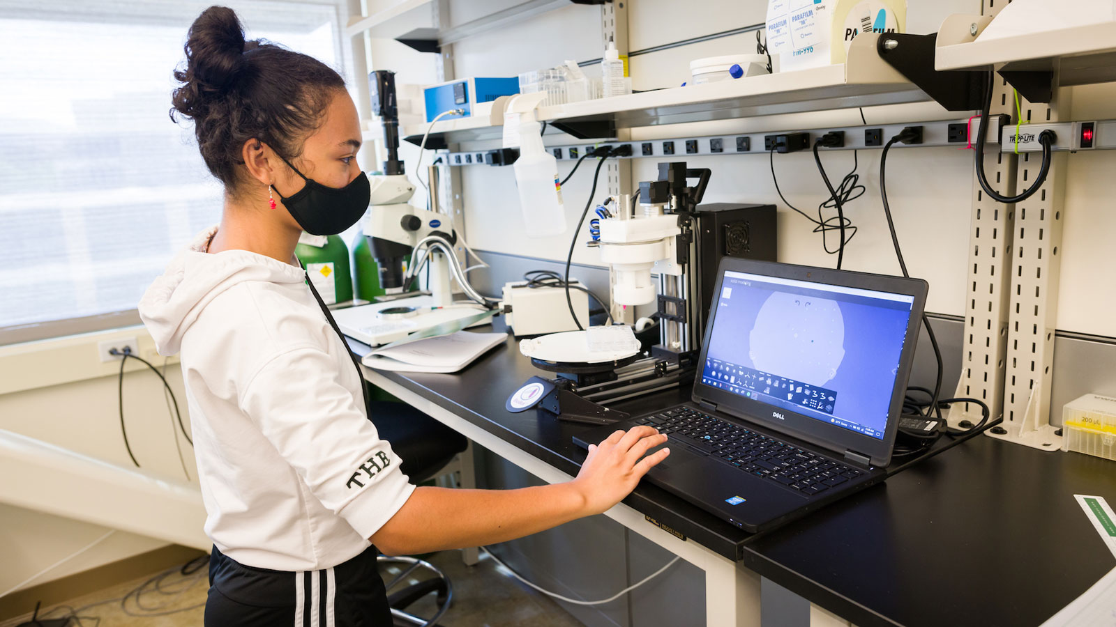 StudSummer Undergraduate Research Program student investigates skeletal muscle progenitor cells.ent in Summer Undergraduate Research program 